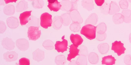 کلایهاور بتکه