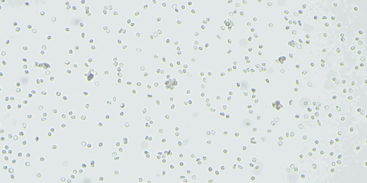 The-rosette-screen-One-drop-of-the-manufacturers-reagentreduced-alkylated-and