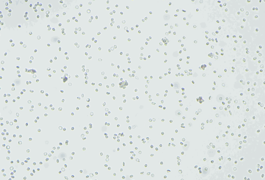 The-rosette-screen-One-drop-of-the-manufacturers-reagentreduced-alkylated-and