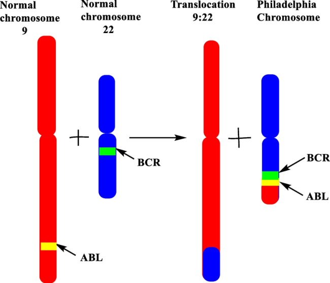 کروموزوم فیلادلفیا کروموزوم فیلادلفیا