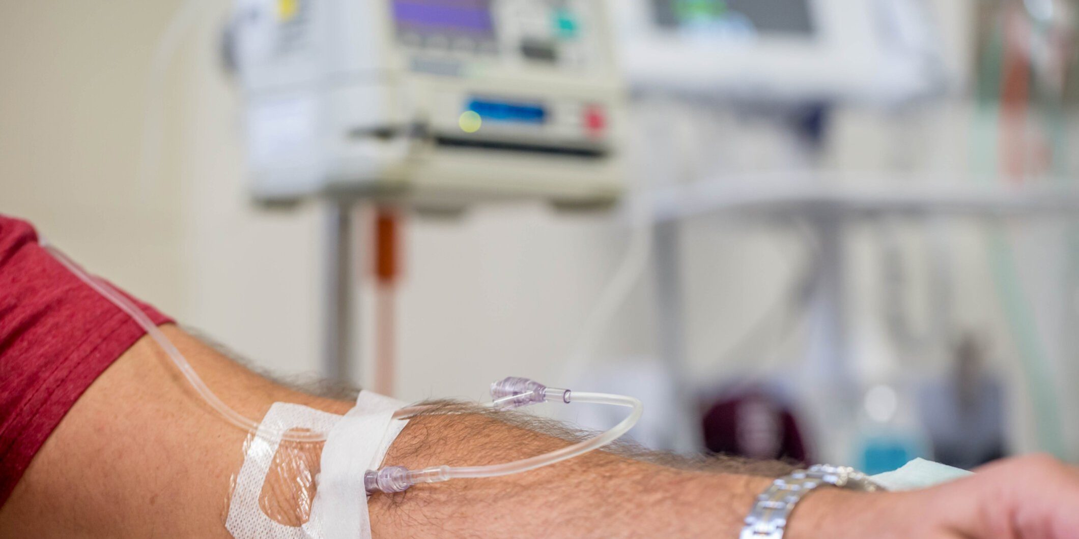 close up view of a mans arm while having an IV immunoglobulin infusion at hospital
