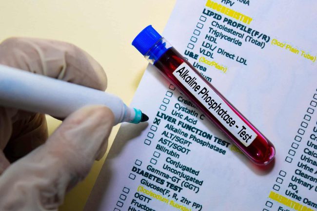 AdobeStock_287154313-scaled