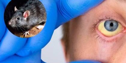 imagen-leptopirosis-enfermedad_101-8266403_20240216162338