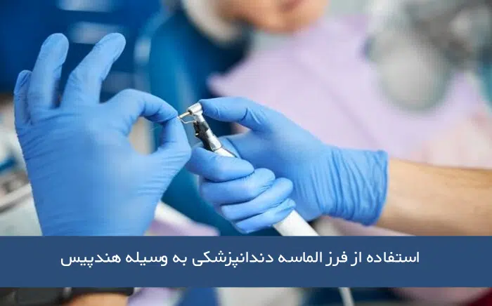 استفاده از فرز الماسه دندانپزشکی به وسیله هندپیس
