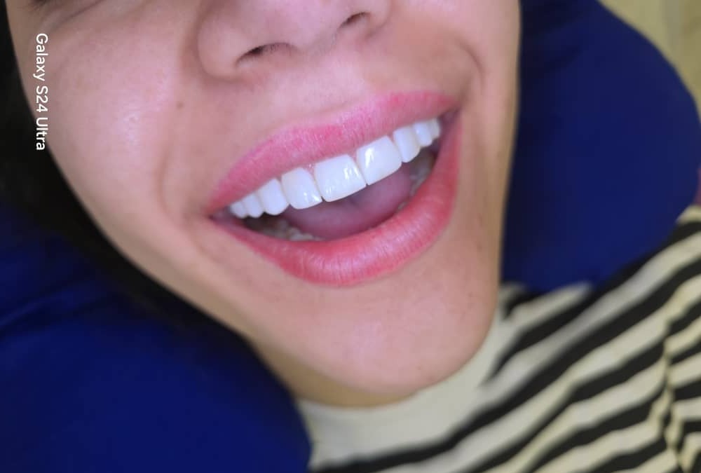 چگونه بهترین دکتر کامپوزیت دندان در شیراز را پیدا کنیم؟ تجربه و مزایا