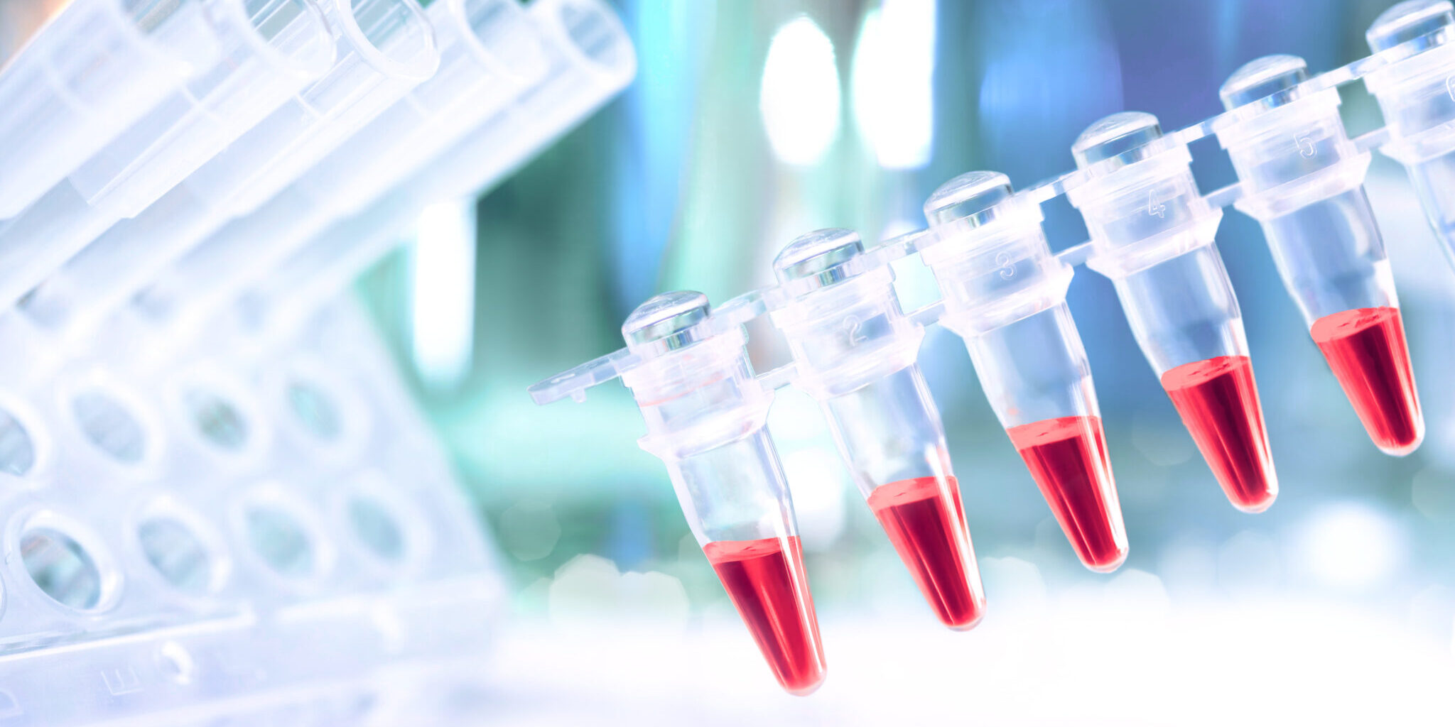 Plastic,Tubes,With,Red,Samples,For,Pcr,Reaction,To,Analyse