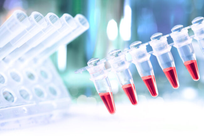 Plastic,Tubes,With,Red,Samples,For,Pcr,Reaction,To,Analyse